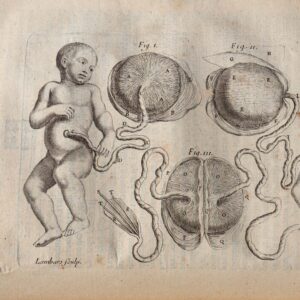 livre sur l'accouchement année 1712 Mauriceau illustration foetus